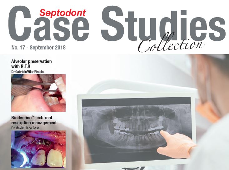 Septodont Case Studies Collection 17 - RTR y Biodentine